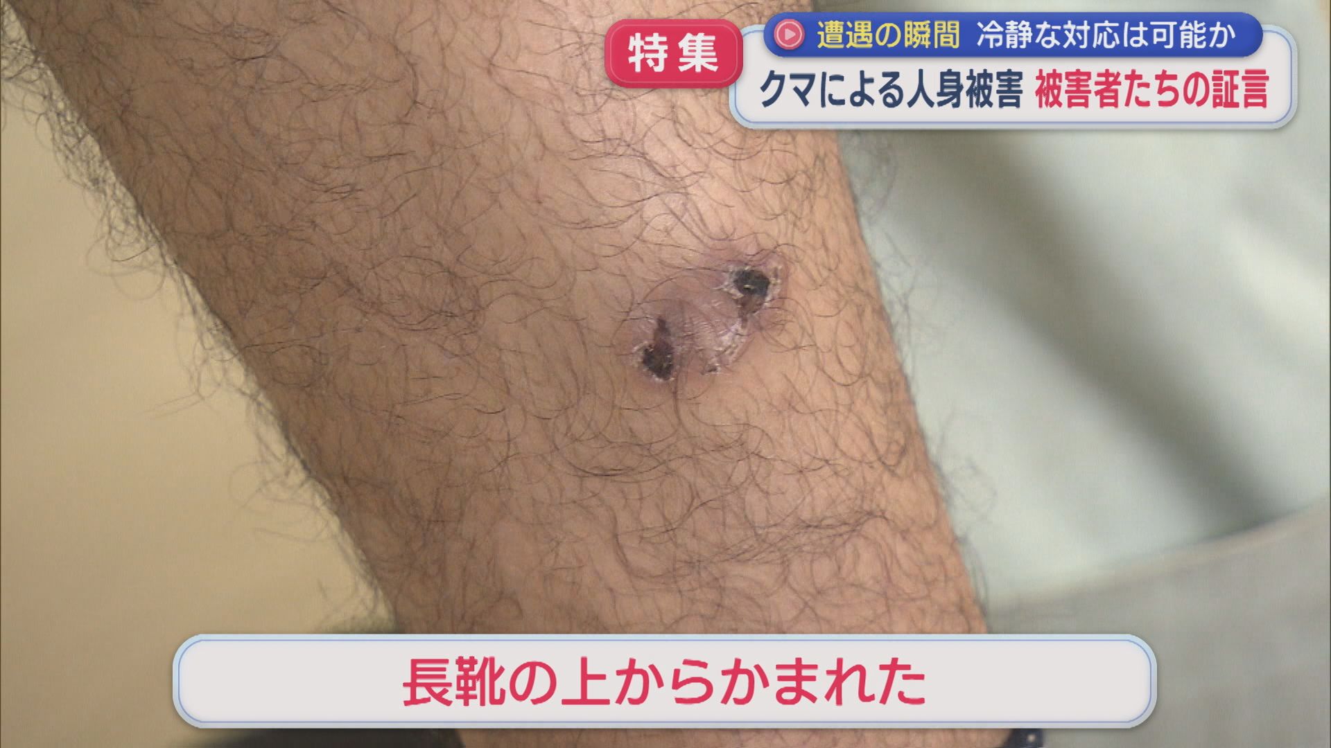 【特集】クマに襲われた被害者たちの証言「首をかまれていたかも」県内の人身被害は過去最多のペース【新潟】 2025年11月12日(水)
