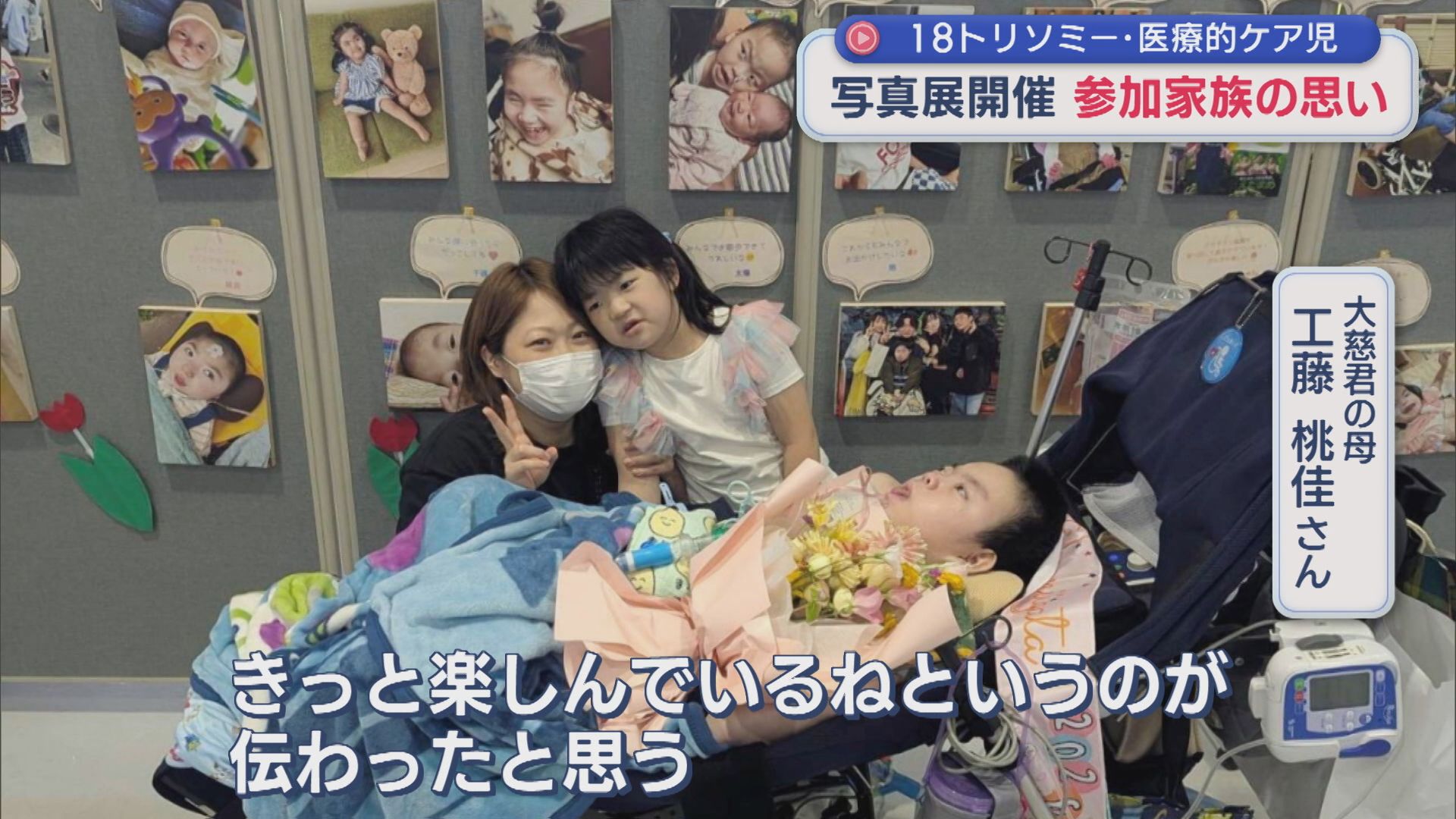 18トリソミー・医療的ケア児 写真展「命の輝きを見て涙が･･･」参加する家族の思い【新潟】 2026年09月07日(月)